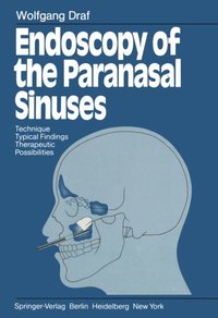 Micro Endoscopic Surgery Of The Paranasal Sinuses And The