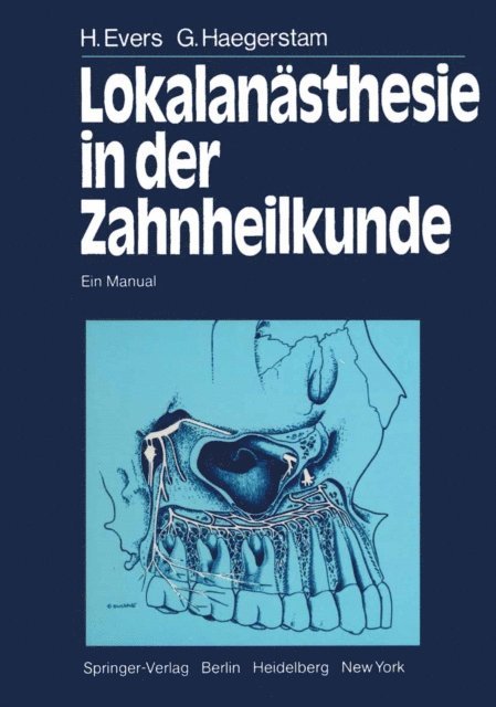 G. Haegerstam, H. Evers, L. Hakansson - Lokalanästhesie in der Zahnheilkunde, E-bok