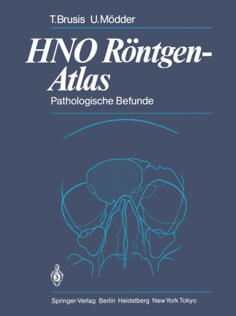 Ulrich Modder, Tilman Brusis - HNO Röntgen-Atlas, E-bok