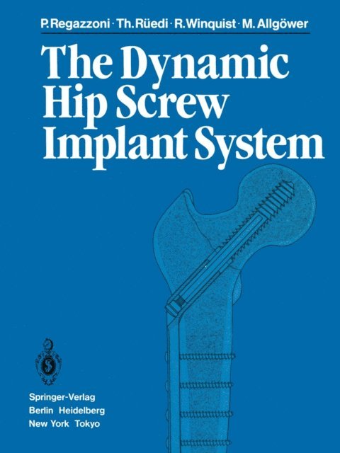 M. Allgower, R. Winquist, T. Ruedi, P. Regazzoni - Dynamic Hip Screw Implant System, E-bok
