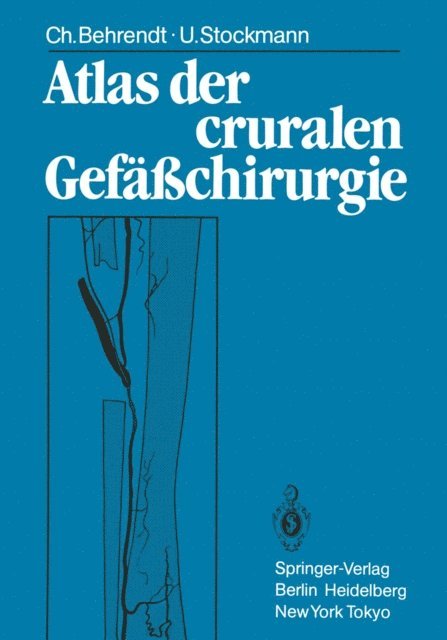 Ulf Stockmann, Christina Behrendt - Atlas der cruralen Gefäßchirurgie, E-bok