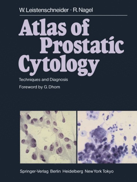 R. Nagel, W. Leistenschneider - Atlas of Prostatic Cytology, E-bok