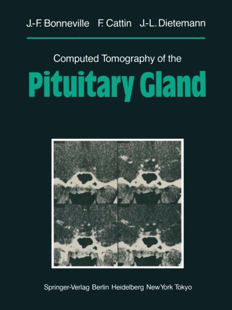 Jean-Louis Dietemann, F. Cattin, Jean-Francois Bonneville - Computed Tomography of the Pituitary Gland, E-bok