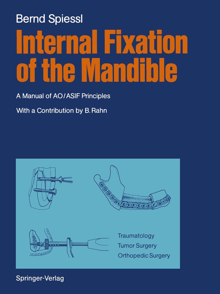 Bernd Spiessl - Internal Fixation of the Mandible, Häftad
