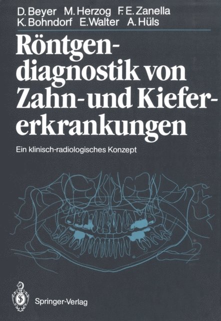 Alfons Huls, Eberhard Walter, Klaus Bohndorf, Friedhelm Zanella, Michael Herzog, Dieter Beyer - Röntgendiagnostik von Zahn- und Kiefererkrankungen, E-bok