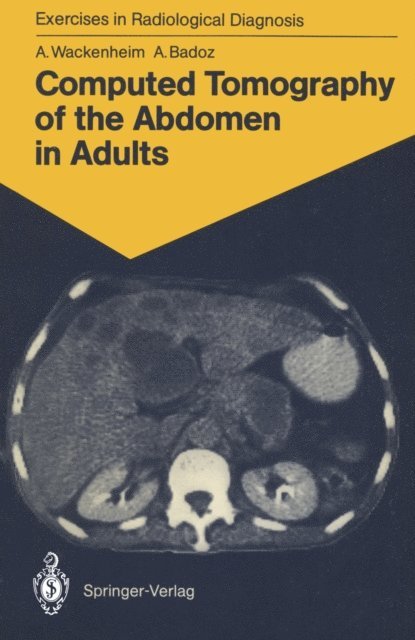 Armelle Badoz, Auguste Wackenheim - Computed Tomography of the Abdomen in Adults, E-bok