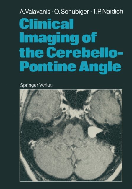 Thomas P. Naidich, Othmar Schubiger, Anton Valavanis - Clinical Imaging of the Cerebello-Pontine Angle, E-bok