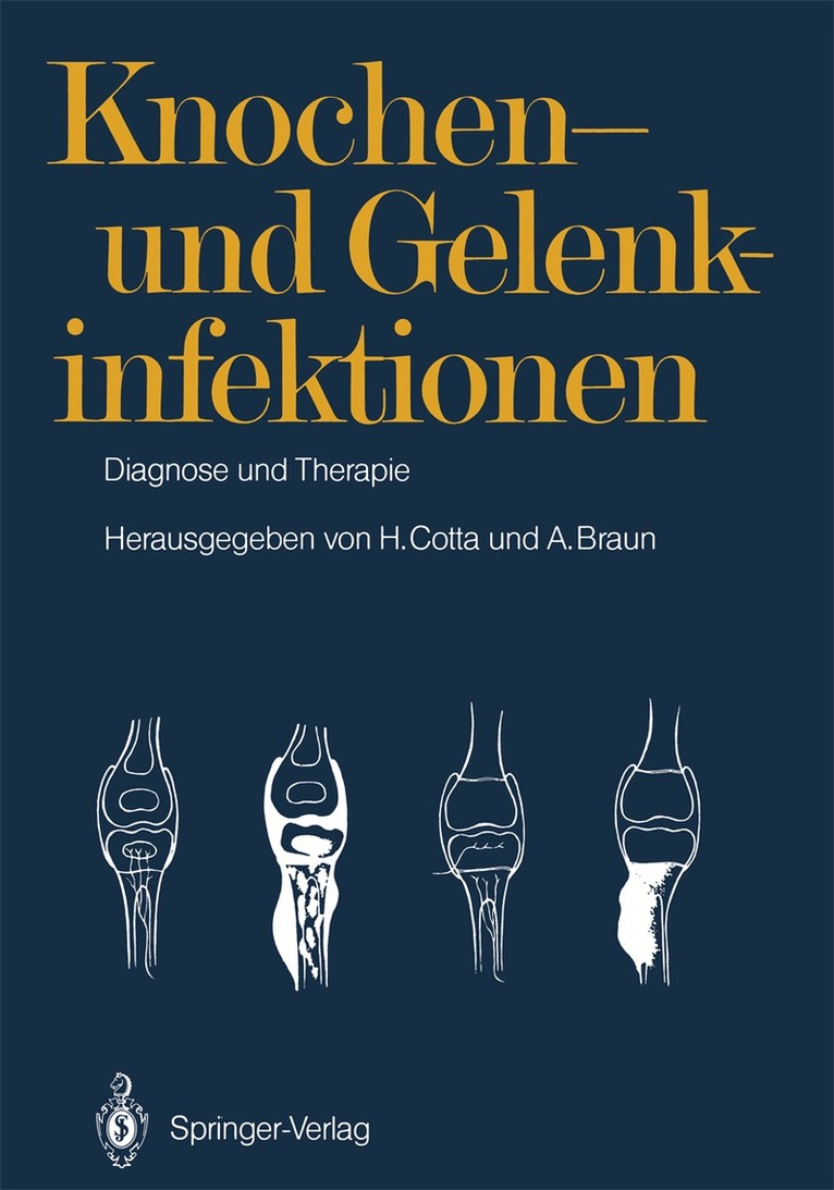 Horst Cotta, Arnim Braun - Knochen- und Gelenkinfektionen, Häftad. Tillgänglighet: Lägg i varukorg