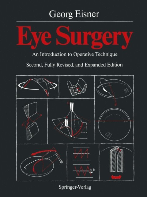 Georg Eisner - Eye Surgery, E-bok