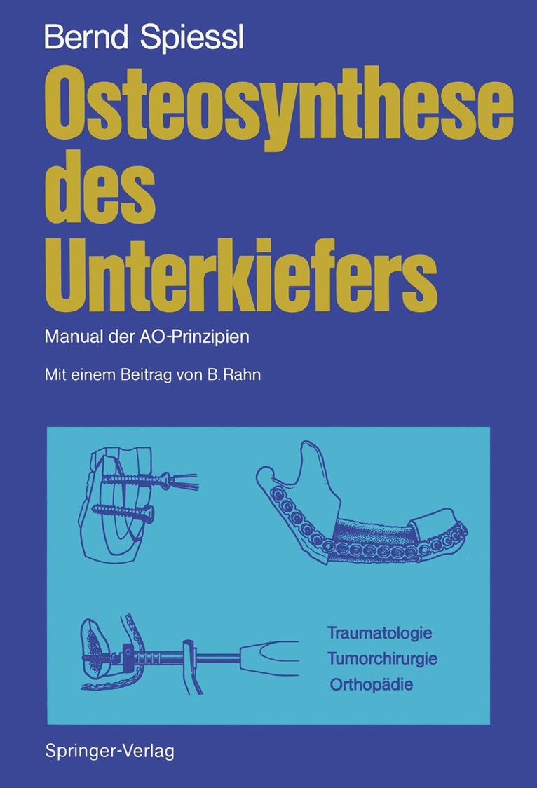 Bernd Spiessl - Osteosynthese des Unterkiefers, Häftad