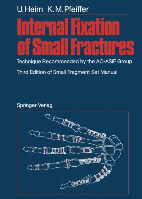 Karl M. Pfeiffer, Urs Heim - Internal Fixation of Small Fractures, E-bok