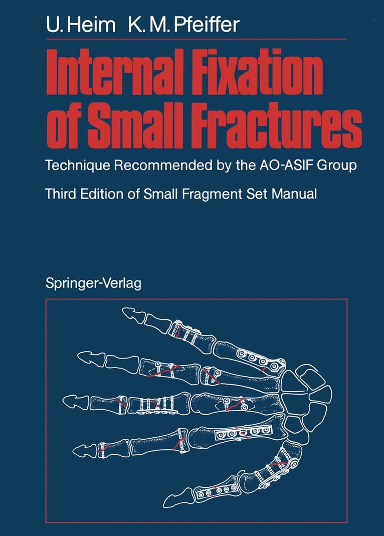 Urs Heim, Karl M. Pfeiffer - Internal Fixation of Small Fractures, Häftad