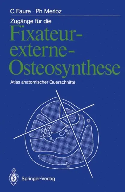 Philippe Merloz, Claude Faure - Zugänge für die Fixateur-externe-Osteosynthese, E-bok. Tillgänglighet: Lägg i varukorg