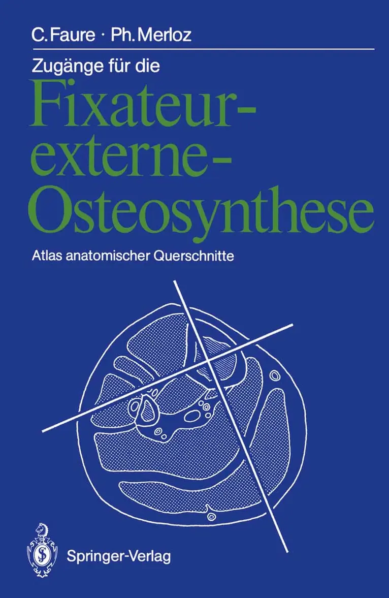 Zugänge für die Fixateur-externe-Osteosynthese