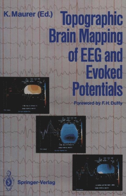 Konrad Maurer - Topographic Brain Mapping of EEG and Evoked Potentials, E-bok