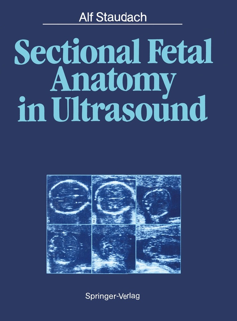 Alf Staudach, Bernd K. Wittmann - Sectional Fetal Anatomy in Ultrasound, Häftad