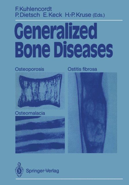 Hans-Peter Kruse, Elmar Keck, Peter Dietsch, Friedrich Kuhlencordt - Generalized Bone Diseases, E-bok