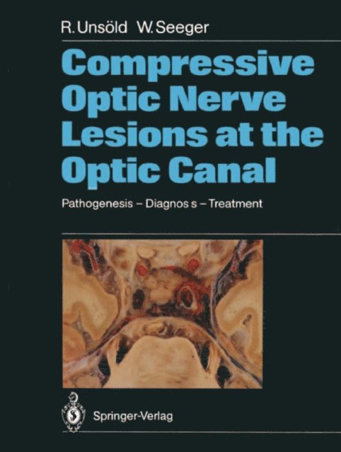Wolfgang Seeger, Renate Unsold - Compressive Optic Nerve Lesions at the Optic Canal, E-bok