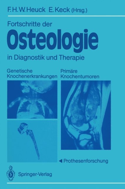 Elmar Keck, Friedrich H.W. Heuck - Fortschritte der Osteologie in Diagnostik und Therapie, E-bok