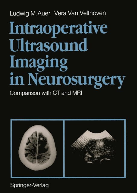 Vera Van Velthoven, Ludwig M. Auer - Intraoperative Ultrasound Imaging in Neurosurgery, E-bok