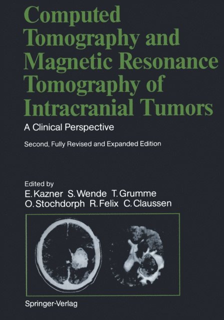 S. Wende, G. Sze, O. Stochdorph, B. Schulz, G. Schroth, W. Schorner, T.H. Newton, W. Muller-Forell, W. Lanksch, M. Laniado, K. Kretzschmar, E. Kazner, J.R. Iglesias-Rozas, J. Heinzerling, T. Grumme, R. Felix, R. Fahlbusch, C. Claussen, Claus Claussen, Roland Felix, Otto Stochdorph, Thomas Grumme, Sigurd Wende, Ekkehard Kazner - Computed Tomography and Magnetic Resonance Tomography of Intracranial Tumors, E-bok