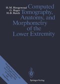 Computed Tomography, Anatomy, and Morphometry of the Lower Extremity