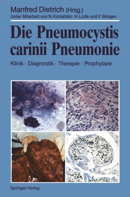 Manfred Dietrich - Die Pneumocystis carinii Pneumonie, E-bok