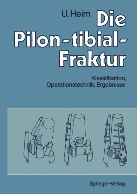 Urs Heim - Die Pilon-tibial-Fraktur, E-bok