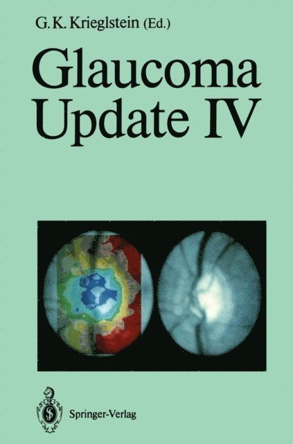 G.K. Krieglstein - Glaucoma Update IV, E-bok
