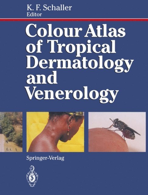 Karl F. Schaller - Colour Atlas of Tropical Dermatology and Venerology, E-bok