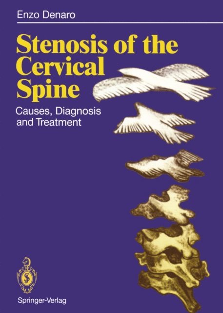 Vincenzo Denaro - Stenosis of the Cervical Spine, E-bok