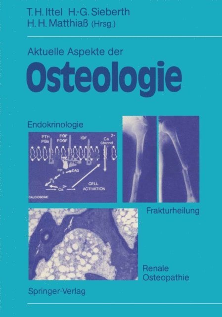 Hans H. Matthia, Heinz-Gunther Sieberth, Thomas H. Ittel - Aktuelle Aspekte der Osteologie, E-bok