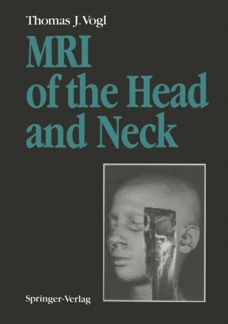 Thomas J. Vogl - MRI of the Head and Neck, E-bok