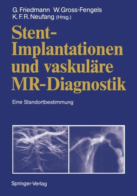 Karl F.R. Neufang, Walter Gross-Fengels, Gerd Friedmann - Stent-Implantationen und vaskuläre MR-Diagnostik, E-bok