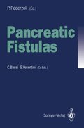 Pancreatic Fistulas