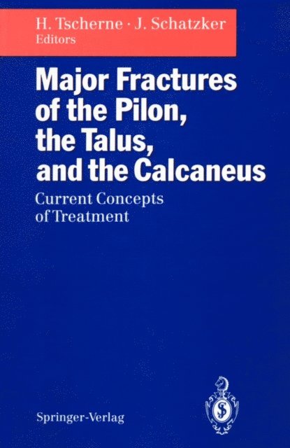 Joseph Schatzker, Harald Tscherne - Major Fractures of the Pilon, the Talus, and the Calcaneus, E-bok
