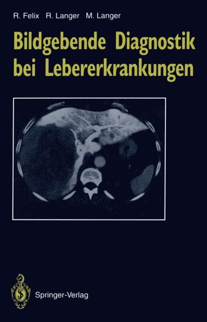 Mathias Langer, Ruth Langer, Roland Felix - Bildgebende Diagnostik bei Lebererkrankungen, E-bok