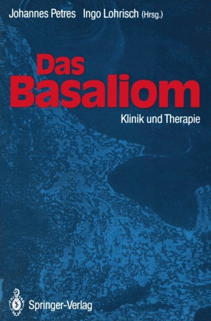 Ingo Lohrisch, Johannes Petres - Das Basaliom, E-bok