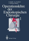 Operationslehre der Endoskopischen Chirurgie 1