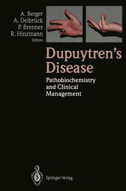 Rolf Hinzmann, Peter Brenner, Axel Delbruck, Alfred Berger - Dupuytren's Disease, E-bok