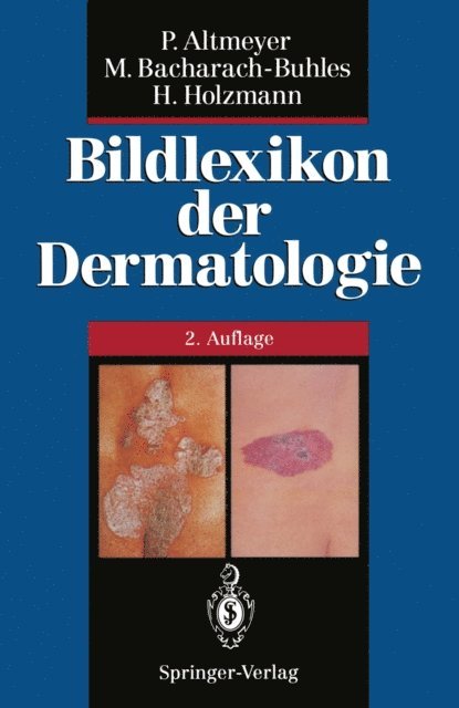 Hans Holzmann, Martina Bacharach-Buhles, Peter Altmeyer - Bildlexikon der Dermatologie, E-bok
