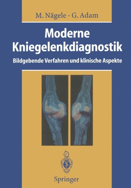 Gerhard Adam, Matthias Nagele - Moderne Kniegelenkdiagnostik, E-bok