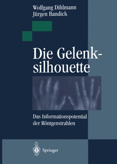 Jurgen Bandick, Wolfgang Dihlmann - Die Gelenksilhouette, E-bok. Tillgänglighet: Lägg i varukorg