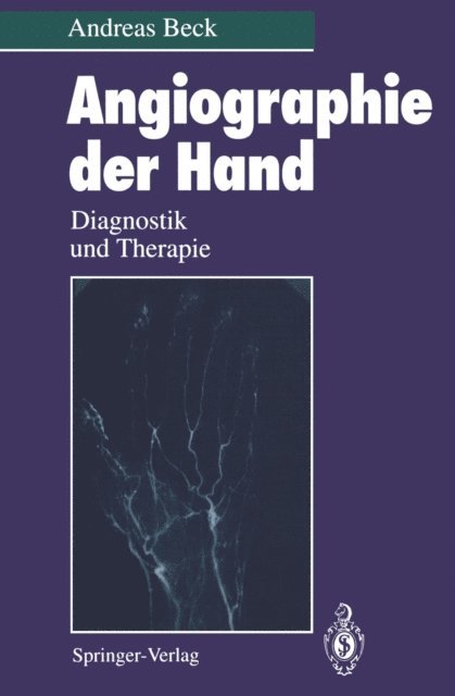 Andreas Beck - Angiographie der Hand, E-bok