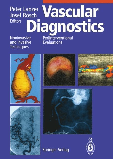 Josef Rosch, Peter Lanzer - Vascular Diagnostics, E-bok