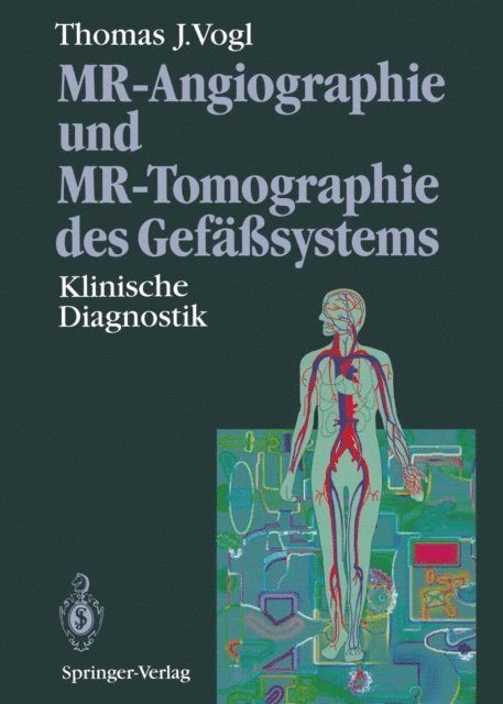 Thomas J. Vogl - MR-Angiographie und MR-Tomographie des Gefäßsystems, E-bok