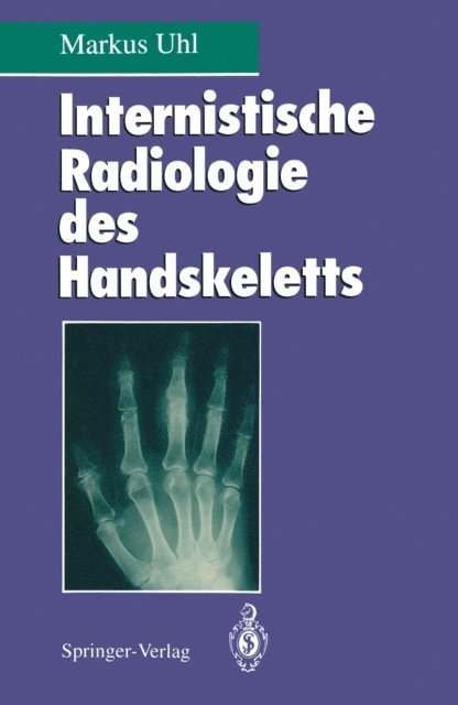 Markus Uhl - Internistische Radiologie des Handskeletts, E-bok