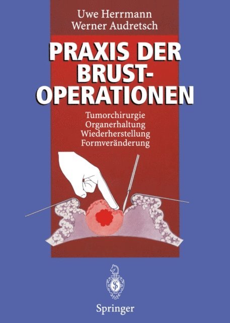 Werner Audretsch, Uwe Herrmann - Praxis der Brustoperationen, E-bok