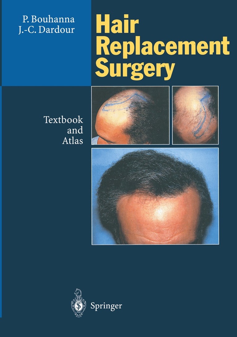 Pierre Bouhanna, Jean-Claude Dardour - Hair Replacement Surgery, Häftad
