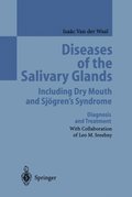 Diseases of the Salivary Glands Including Dry Mouth and Sjogren's Syndrome